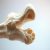 Osteoporoza: objawy, diagnostyka i skuteczne metody zapobiegania